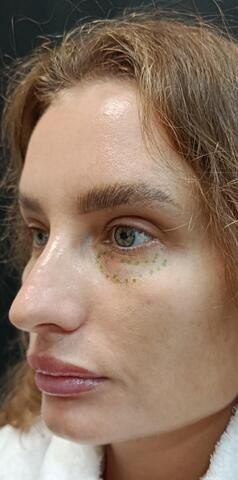 Балкаров Азамат Альбертович: фото 6 до