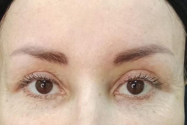 Балкаров Азамат Альбертович: фото 2 после