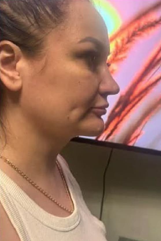 Балкаров Азамат Альбертович: фото 24 после