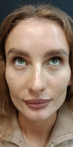 Балкаров Азамат Альбертович: фото 4 после