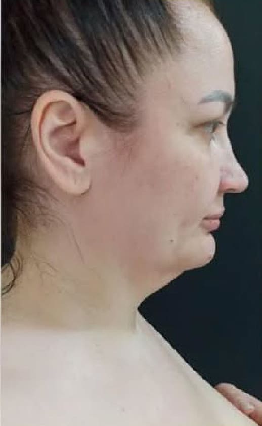 Балкаров Азамат Альбертович: фото 24 до