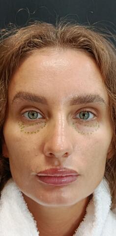 Балкаров Азамат Альбертович: фото 7 до