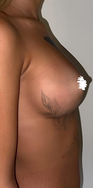 Балкаров Азамат Альбертович: фото 15 после