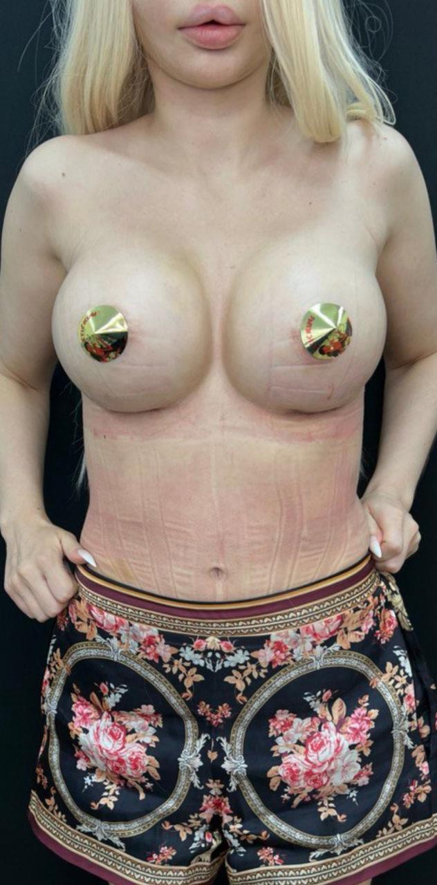 Балкаров Азамат Альбертович: фото 21 после