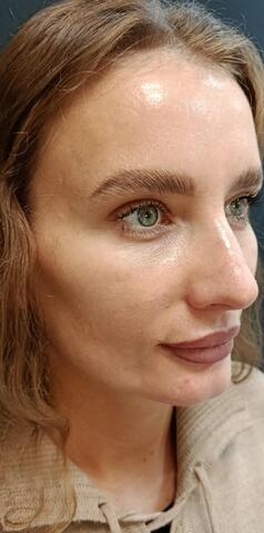 Балкаров Азамат Альбертович: фото 5 после