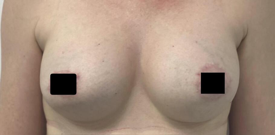 Тураханова Гульнора Тураевна: фото 44 после