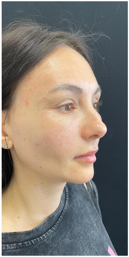 Журавлев Роман Вячеславович: фото 2 после