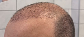 Шаматрина Екатерина Игоревна: фото 3 после