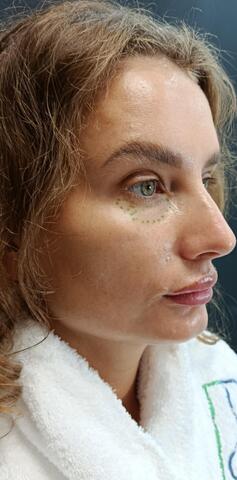 Балкаров Азамат Альбертович: фото 5 до