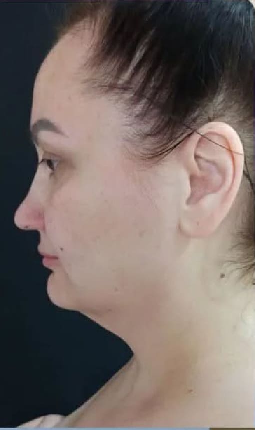 Балкаров Азамат Альбертович: фото 23 до