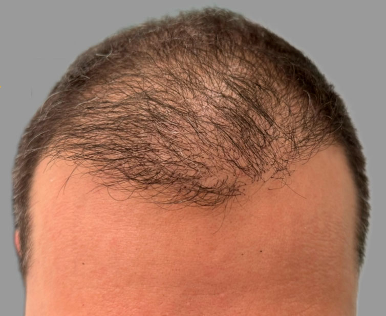 Шаматрина Екатерина Игоревна: фото 2 после