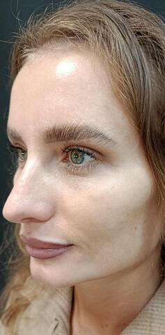 Балкаров Азамат Альбертович: фото 6 после