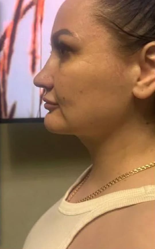 Балкаров Азамат Альбертович: фото 23 после