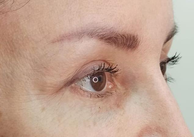 Балкаров Азамат Альбертович: фото 1 после