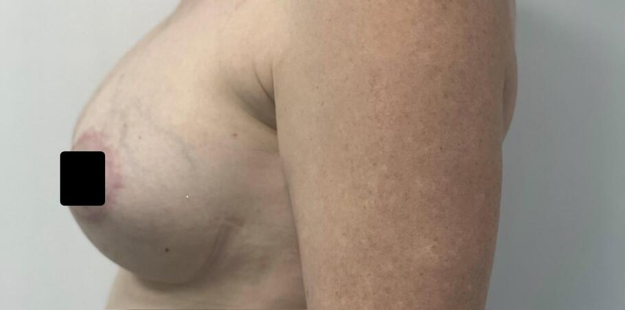 Тураханова Гульнора Тураевна: фото 41 после