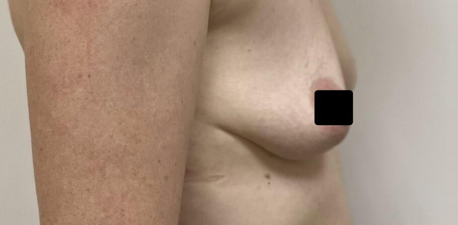 Тураханова Гульнора Тураевна: фото 40 до