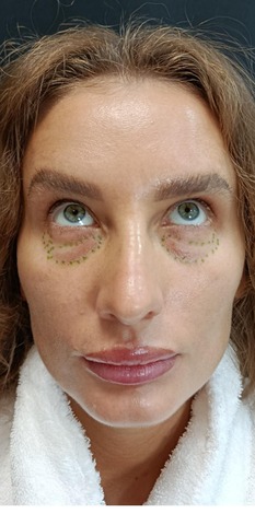 Балкаров Азамат Альбертович: фото 4 до