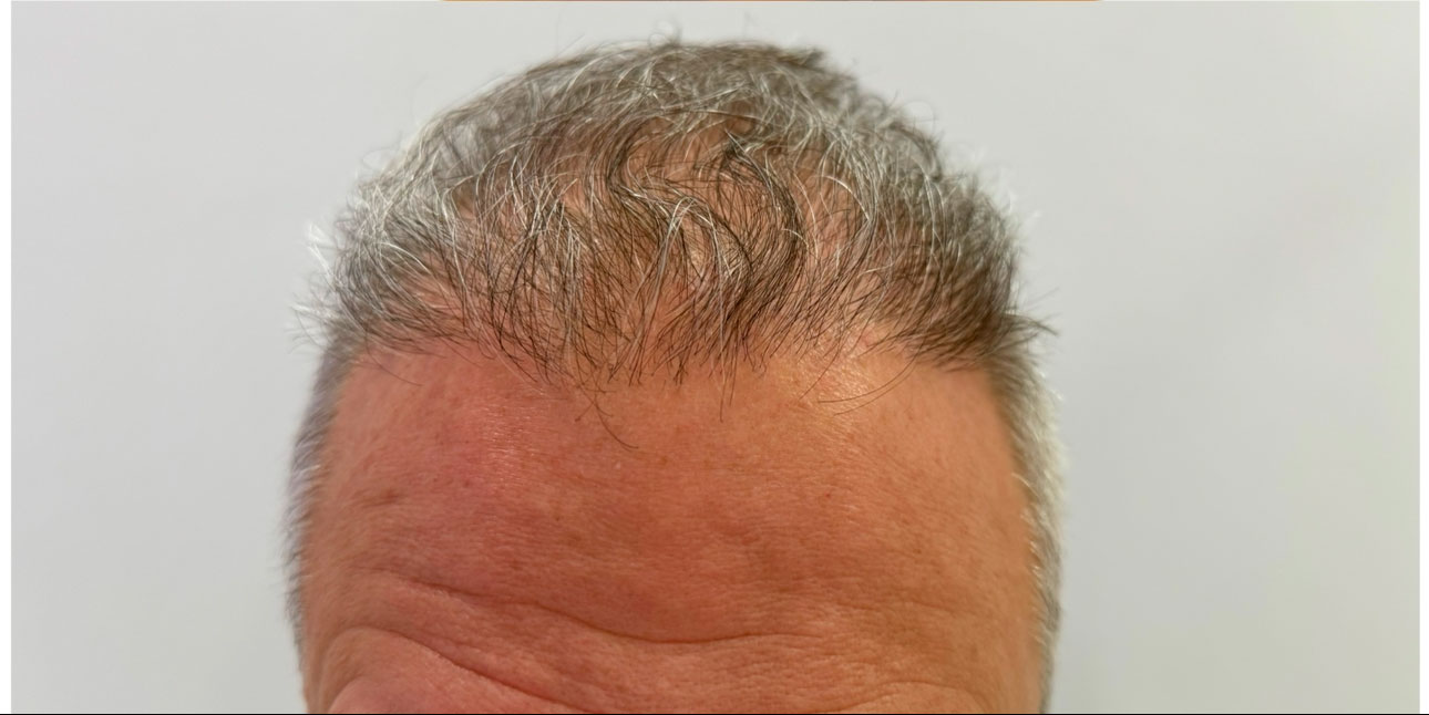 Шаматрина Екатерина Игоревна: фото 1 после