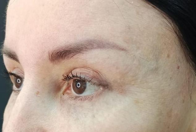 Балкаров Азамат Альбертович: фото 3 после