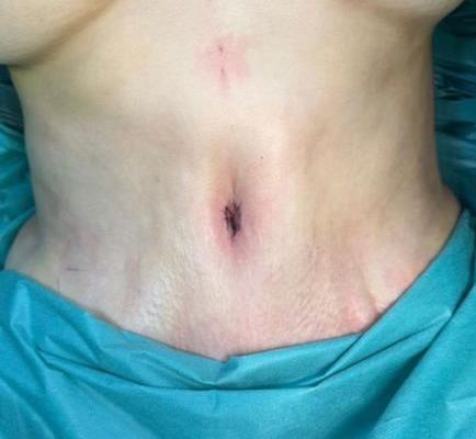 Шаповалов Сергей Николаевич: фото 24 после