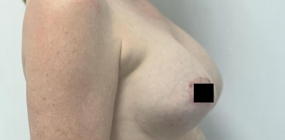 Тураханова Гульнора Тураевна: фото 40 после