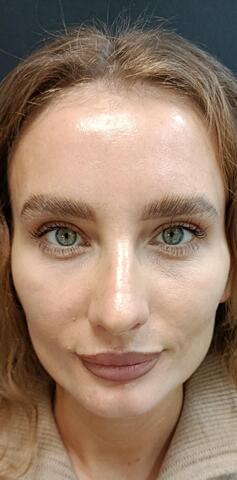 Балкаров Азамат Альбертович: фото 7 после