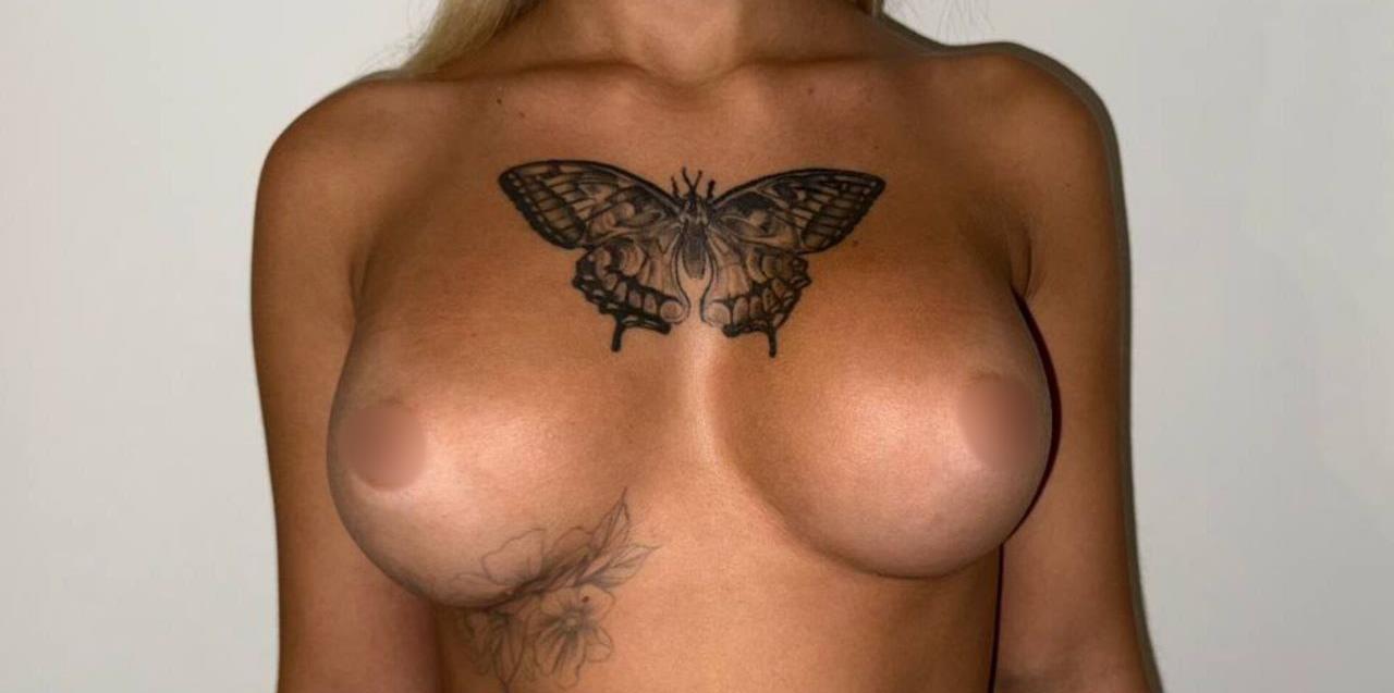 Балкаров Азамат Альбертович: фото 18 после