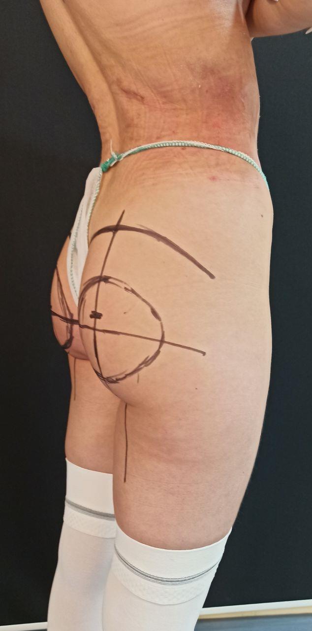 Балкаров Азамат Альбертович: фото 22 до