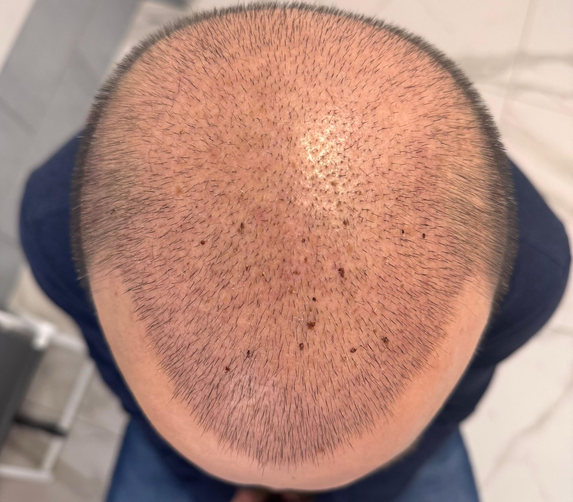 Шаматрина Екатерина Игоревна: фото 4 после