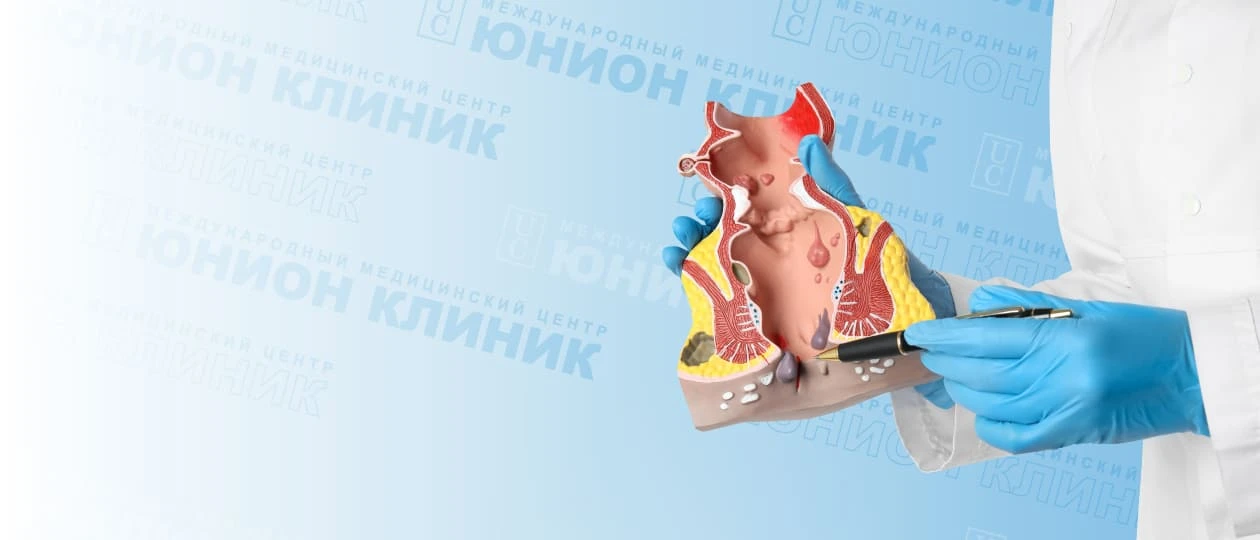 Склеротерапия геморроидальных узлов