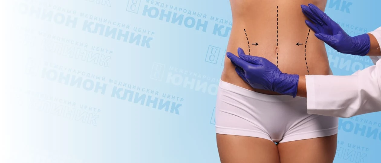 Скидка на пластику живота
