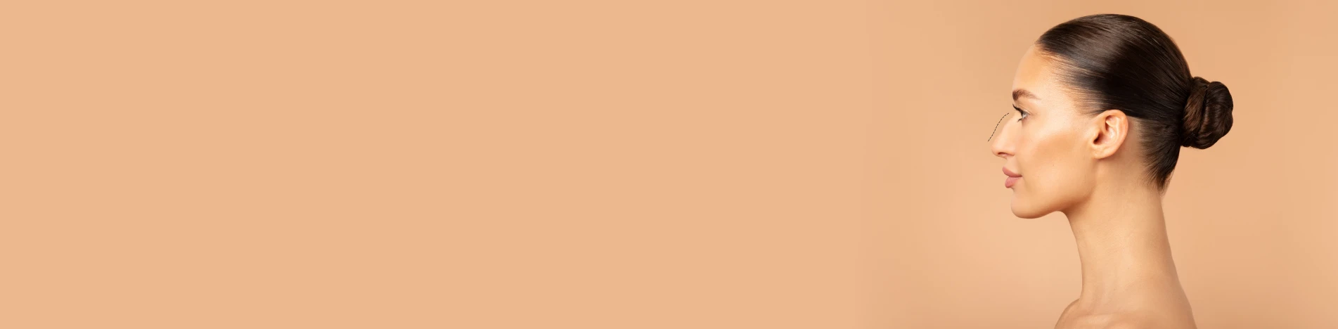 Горбинка на носу