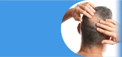 Пересадка волос при андрогенетической алопеции