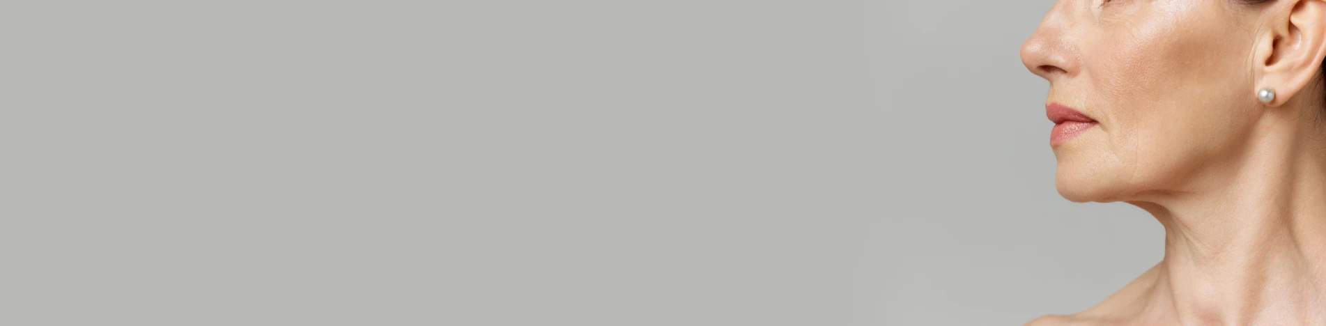 Вертикальные морщины