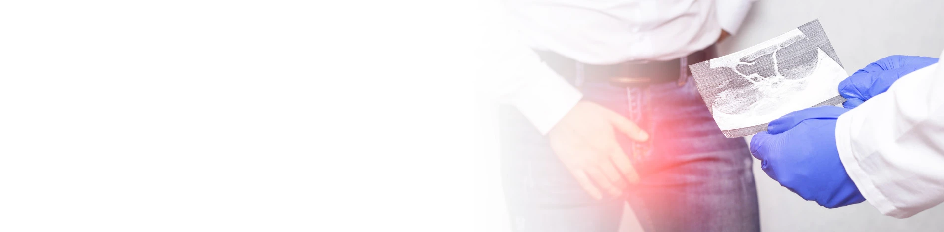 Перекрут яичка