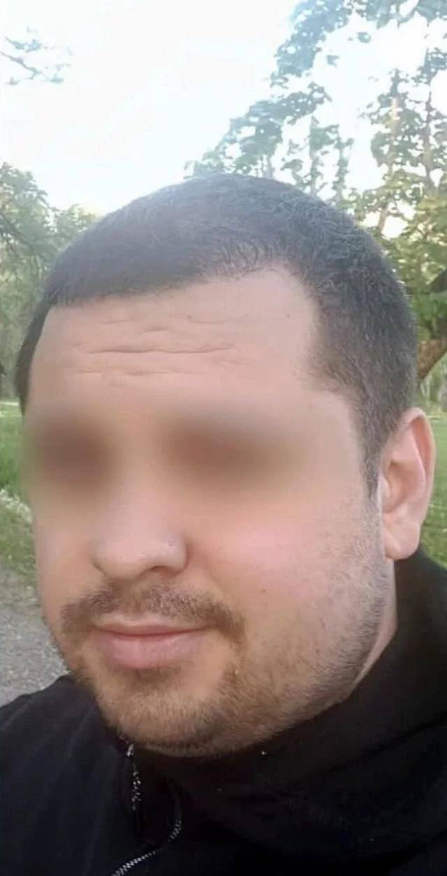 Пересадка волос при сенильной алопеции: фото 2 после